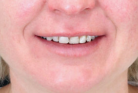 patient smile