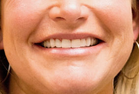 patient smile