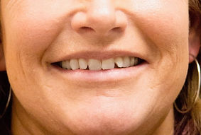 patient smile