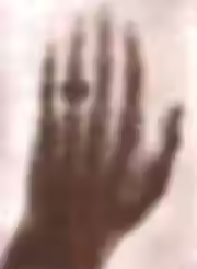 Рентгенограма руки дружини Вільгельма Рентгена