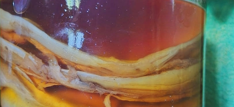 Fermented Probiotic Drink - Kombucha