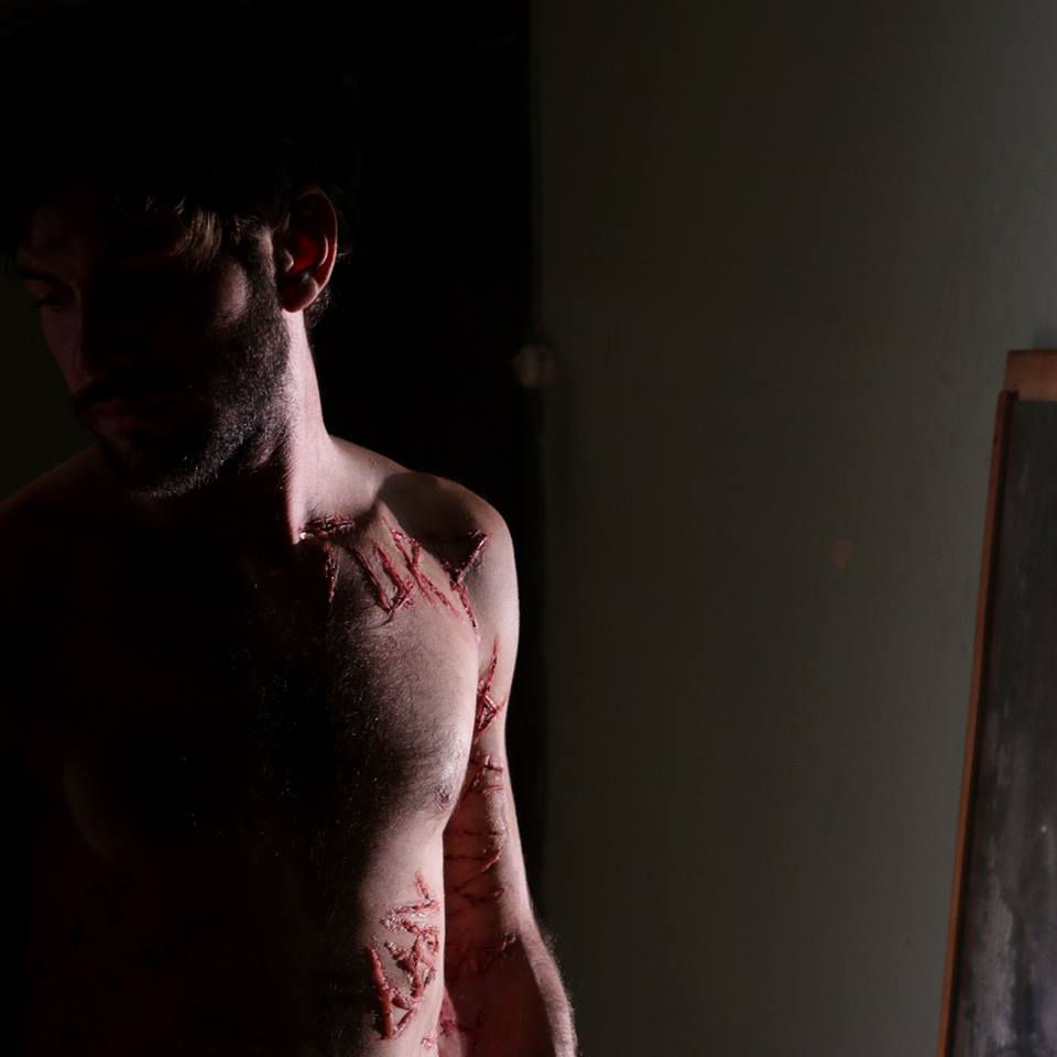 TURP Curta-metragem (Miguel Nunes)