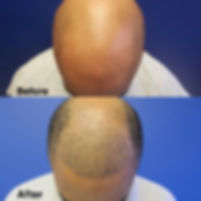 image4 (1).jpeg
