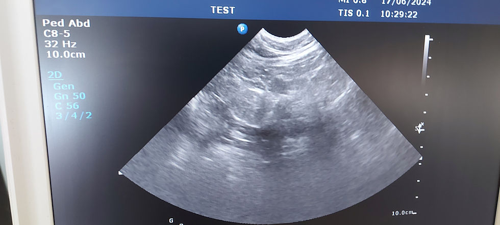 Thumbnail: Phillips C8-5 Paediatric probe / transducer