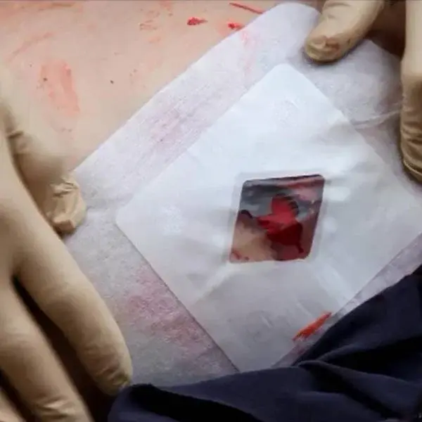 Thumbnail: Russell Chest Seal – Vented Hydrogel Dressing for Penetrating Chest Wounds