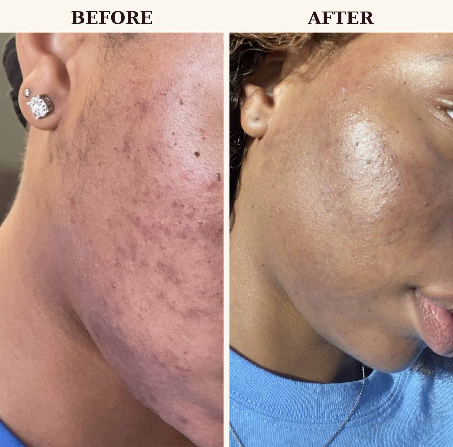 Rich radiance + bundle | 90 days to brighter skin