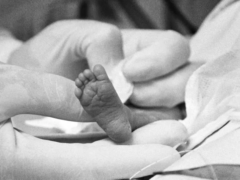 pictureofprematurebaby.jpg-2.webp