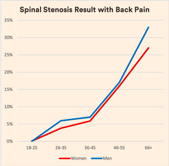 Spinal Stenosis and Back Pain