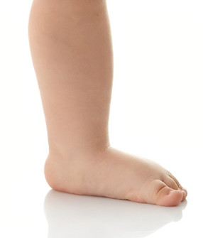 childrens flat feet.jpg