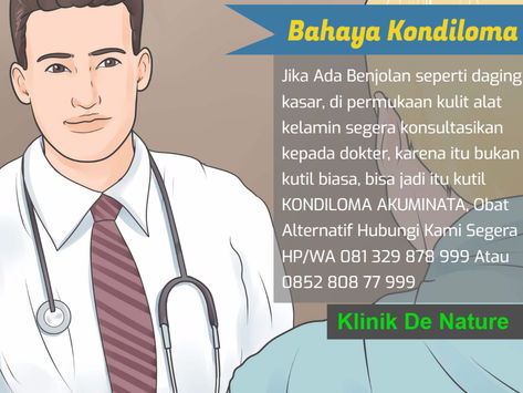 Cara Mengobati Kutil Pada Kelamin
