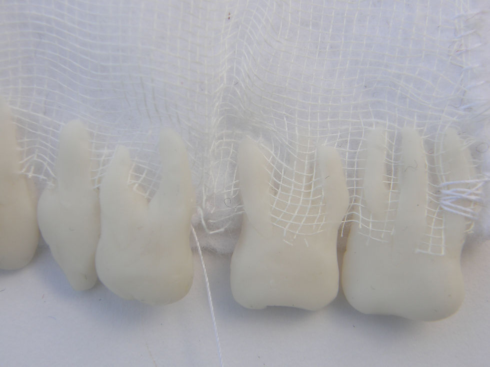 dents