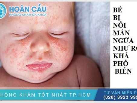 Mẩn ngứa ở bé: những điều cần biết