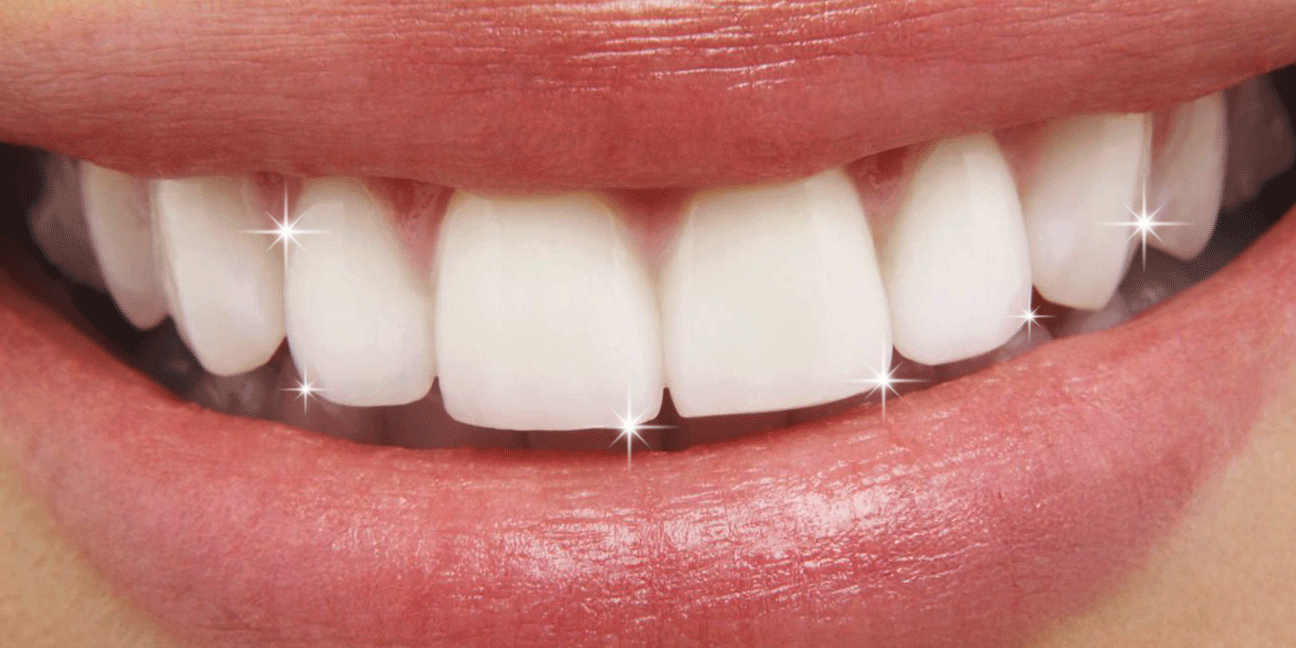 06_Teeth_0105