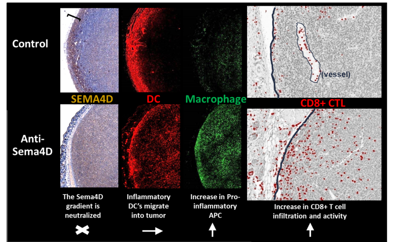 Immunohistochemisty images of tumors illustrating SEMA4D localization to the outer edge. Top row shows control treated and bottom row is treated with anti-SEMA4D. Dendritic cells are shown in red and macrophages are shown in green. CD8+ T cells are shown in red. Treatment with anti-SEMA4D shows neutralization of the SEMA4D gradient, migration of inflammatory DCs into the tumor and an increase in pro-inflammatory APC cells in the tumor. The treatment also shows and increase in CD8+ T cell infiltration and activity.