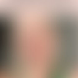 Summer skin rehab for glowing healthy skin