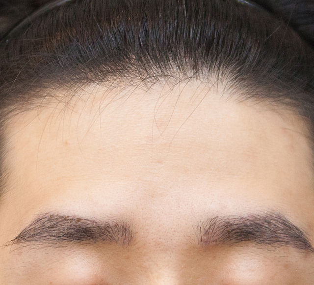 Tibbiy fetish porno Qattiq anal jinsiy aloqa xxx