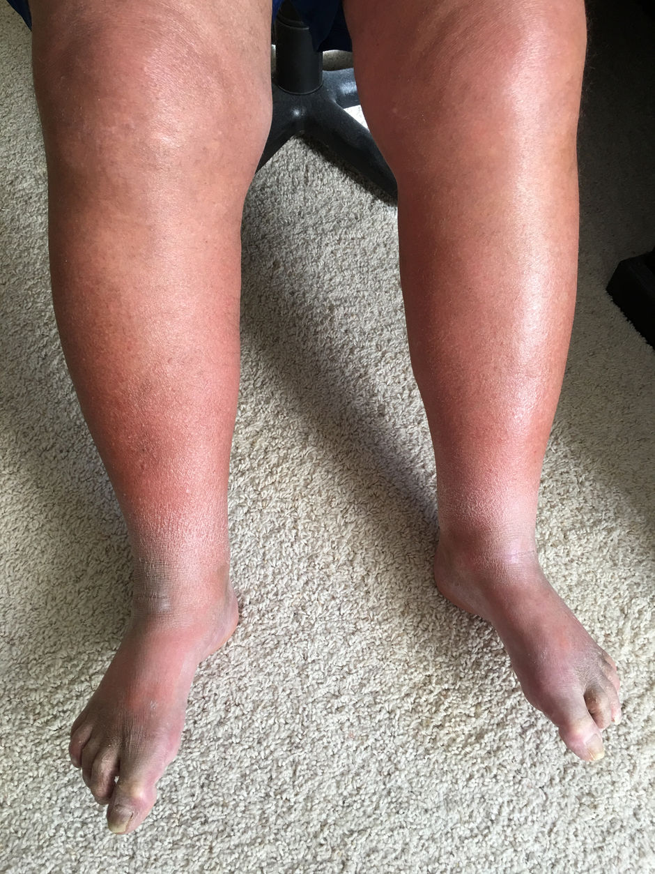 Chinese Herbs for DM, and mental problems