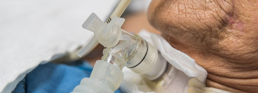 Doctor performing a tracheostomy procedure on a patient