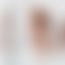 Glass Skin: Is It Achievable or Just a Trend?