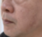 嫩膚去斑效果.JPG