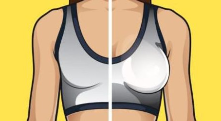 Para ter mais informações sobre a mamoplastia híbrida (combinação de técnicas)
