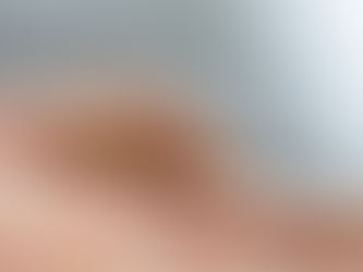 Believe It or Not Getting Stung By Bees Can Be Good For You