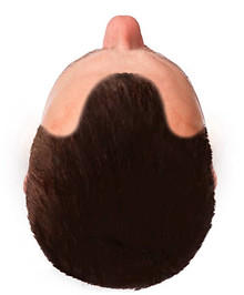 top-of-a-mans-head-with-male-pattern-baldness-isolated-on-a-white-BGEDFD  (2) (1) (1) (1) 