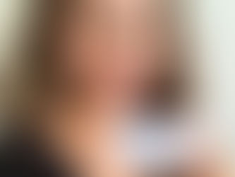 A Beauty Editor Reviews the Wrinkle Patches