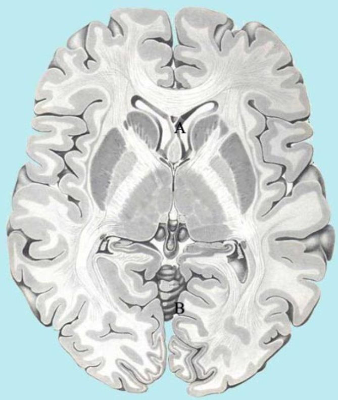 So many people are interested in the brain, maybe this is what they ar