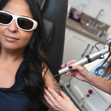 Essential Medi Spa - What is laser tattoo removal_.jpg