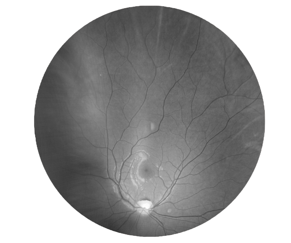 this eye copy.jpg