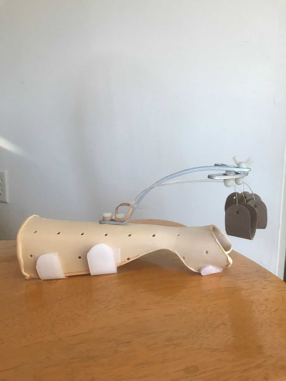 Extensor tendon injury dynamic splint 4