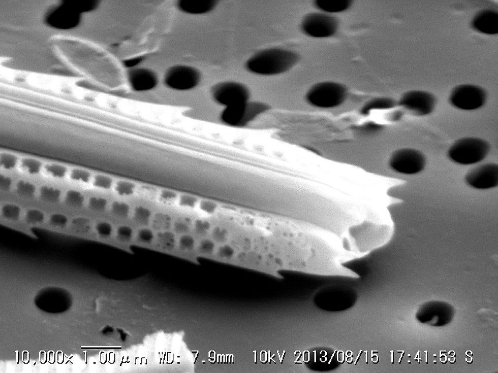 Thalassiothrix sp.