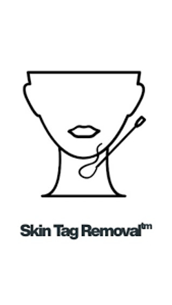 Skin Tag Removal