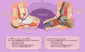 ottawa ankle at clinical physio st ives