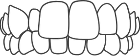 custom_images_services_crossbite.webp