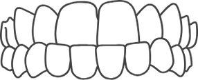 custom_images_services_underbite.webp