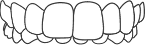 custom_images_services_overbite.webp