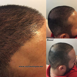 Saç Simulasyonu Uygulamamız