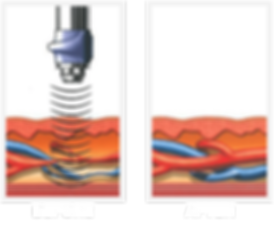 before (1).png