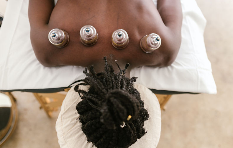 Cupping Therapy_edited.jpg