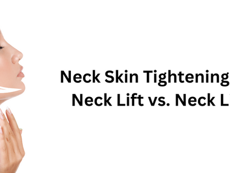 Neck Skin Tightening Showdown: Neck Lift Vs. Neck Liposuction