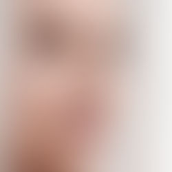 What Makes Dr. Jain's Rhinoplasty Approach Different