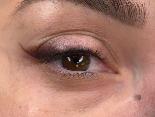 Lash Enhancement