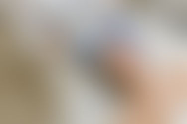 Can You Tighten Face Skin and Reduce Cellulite Without Downtime?