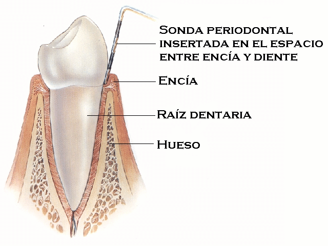 Salud Periodontal