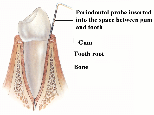 Healthy Gums