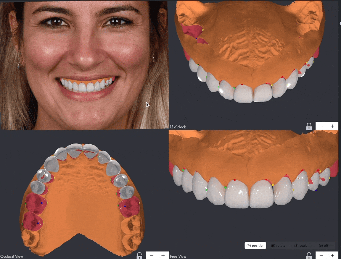 digital smile design by implant depot