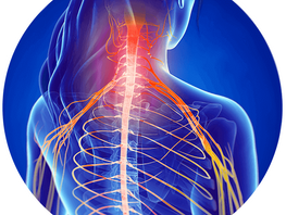 Pinched Nerve  