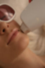 Smooth, texture-free skin from IPL laser treatment from Levy Aesthetics Bellevue